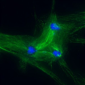 Liver cells.