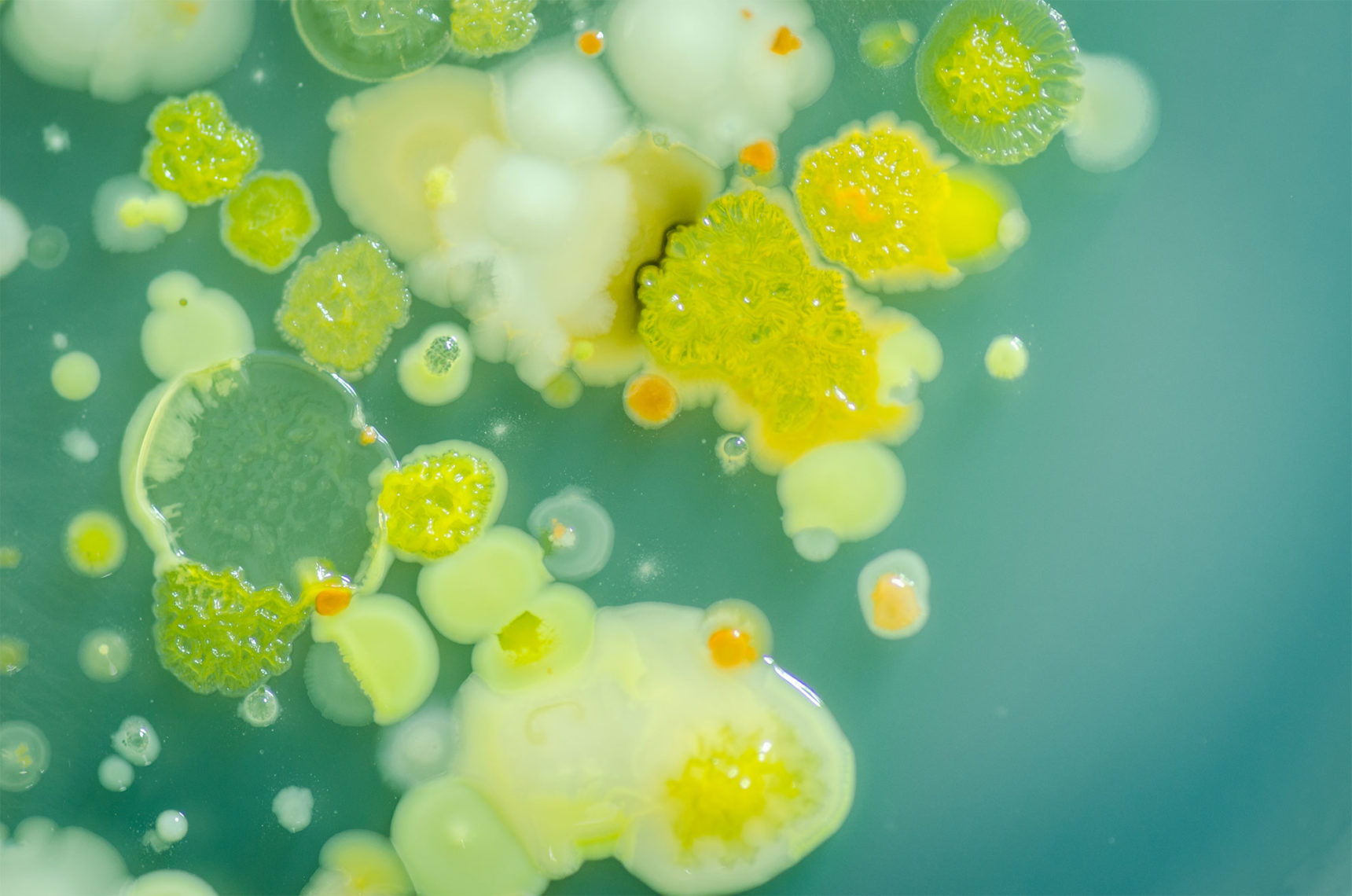 Microbe Math Simpler Math Tames the Complexity of Microbe Networks | Quanta Magazine
