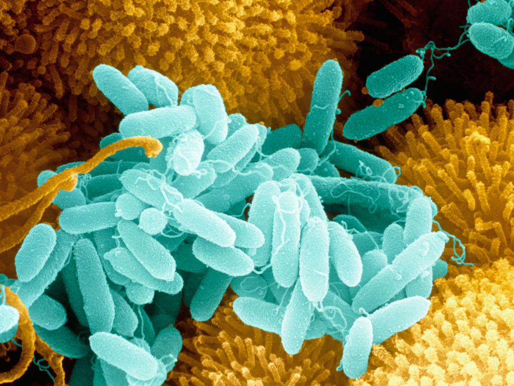 Biodiversity Alters Strategies Of Bacterial Evolution Quanta Magazine biodiversity-alters-strategies-of-bacterial-evolution-quanta-magazine