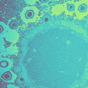 Electron micrograph showing a viral factory and new viral particles inside a cell.