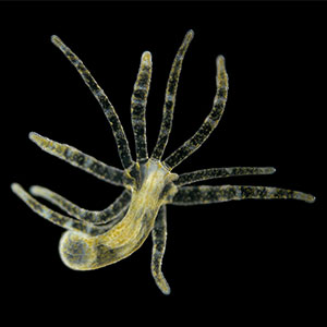 Video of a hydra moving against a dark background.