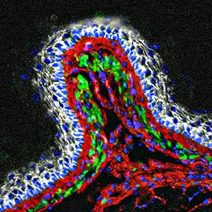 cover of episode In the Gut's 'Second Brain,' Key Agents of Health Emerge