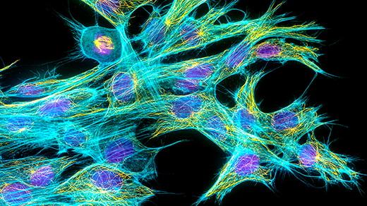 Light microscopy image of fibroblast cells. The cell nuclei are stained purple; parts that make up the rod-like structures of the cytoskeleton are stained cyan for actin filaments and yellow for the microtubule filaments.