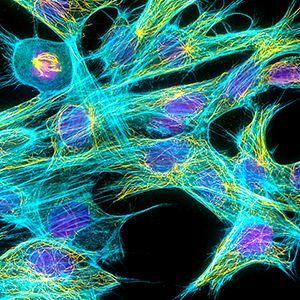Light microscopy image of fibroblast cells. The cell nuclei are stained purple; parts that make up the rod-like structures of the cytoskeleton are stained cyan for actin filaments and yellow for the microtubule filaments.