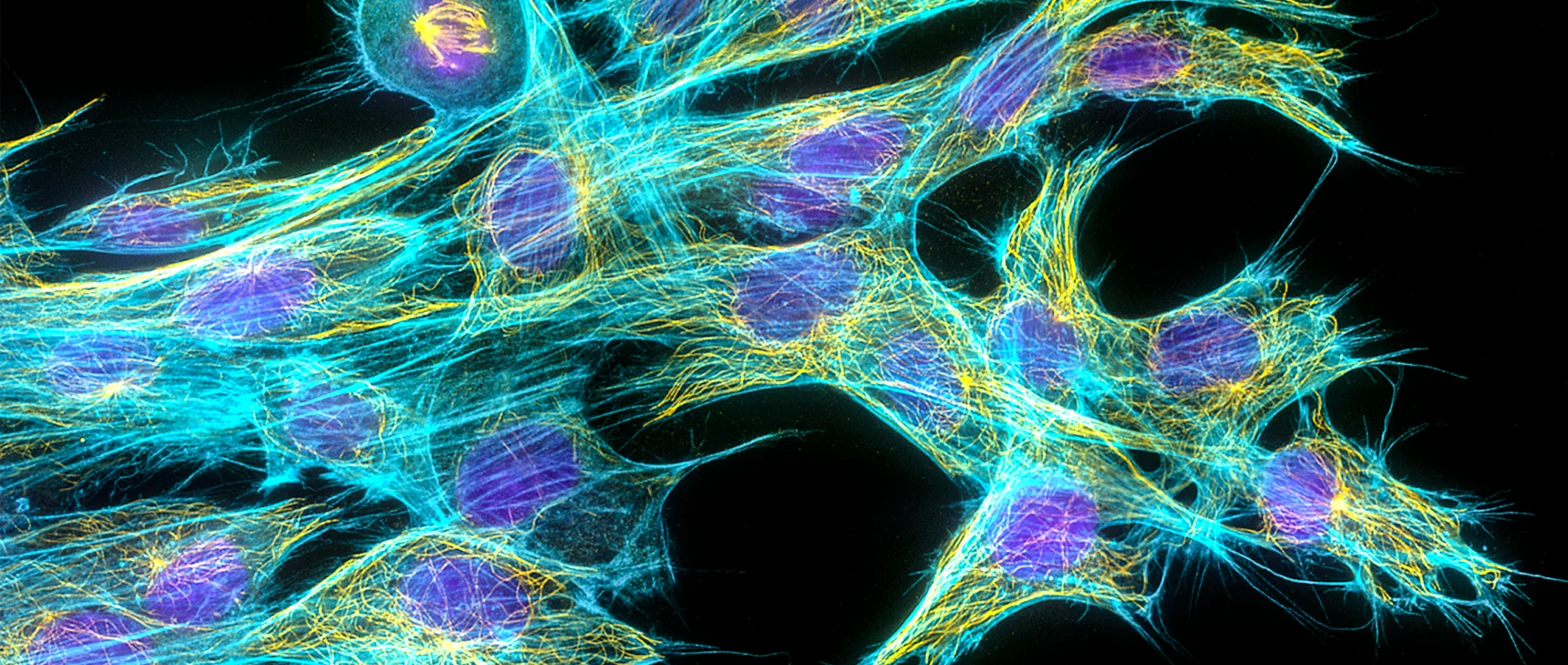 Light microscopy image of fibroblast cells. The cell nuclei are stained purple; parts that make up the rod-like structures of the cytoskeleton are stained cyan for actin filaments and yellow for the microtubule filaments.