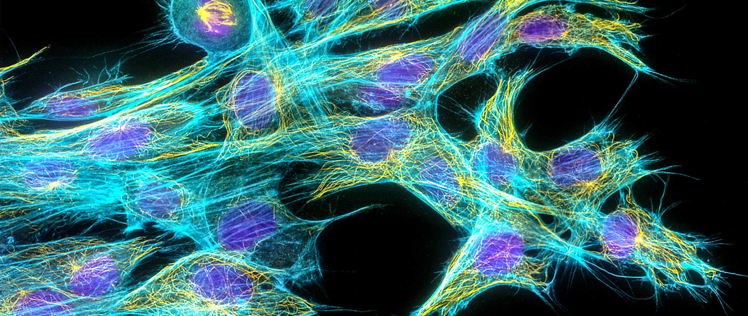 Light microscopy image of fibroblast cells. The cell nuclei are stained purple; parts that make up the rod-like structures of the cytoskeleton are stained cyan for actin filaments and yellow for the microtubule filaments.