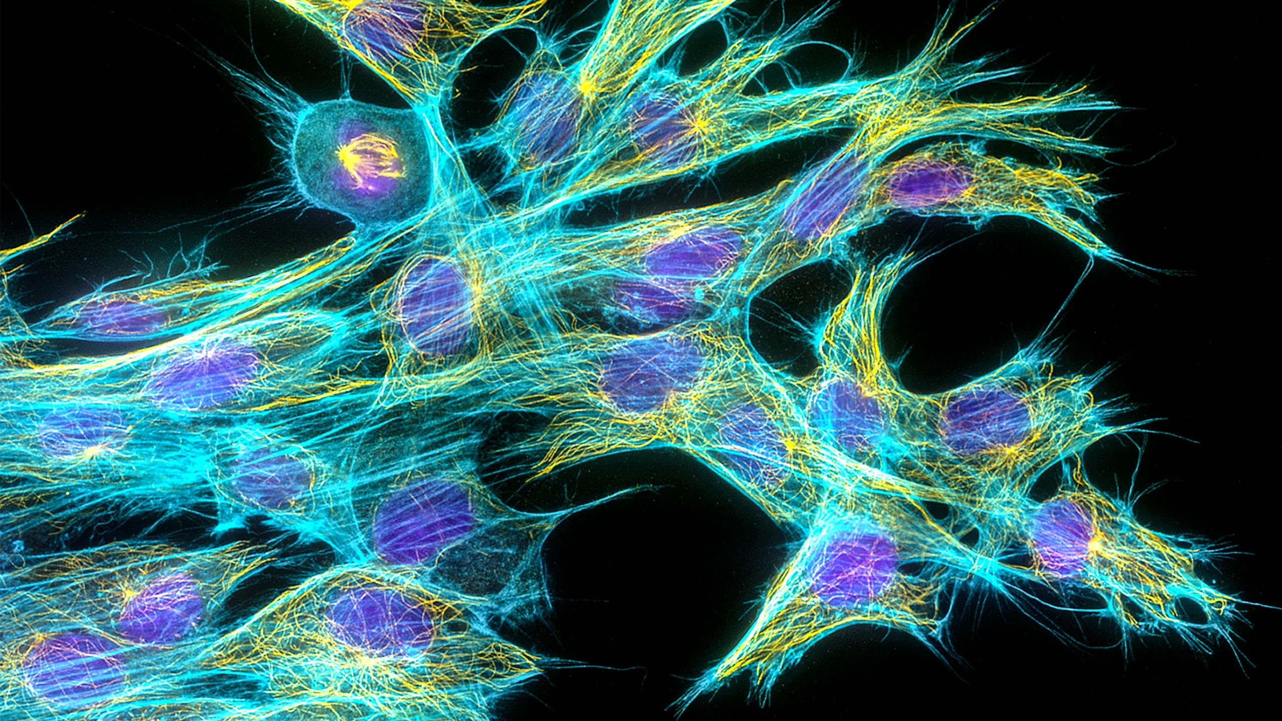 Light microscopy image of fibroblast cells. The cell nuclei are stained purple; parts that make up the rod-like structures of the cytoskeleton are stained cyan for actin filaments and yellow for the microtubule filaments.