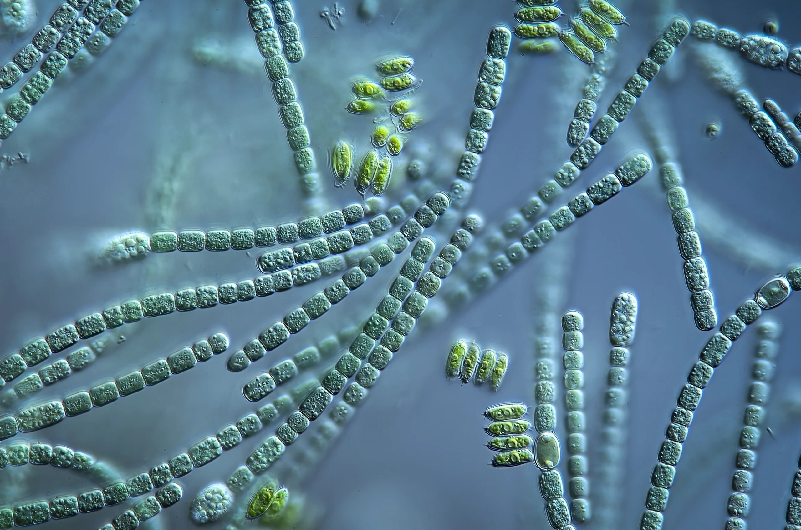 Cyanobacteria cells line up like beads in a necklace.