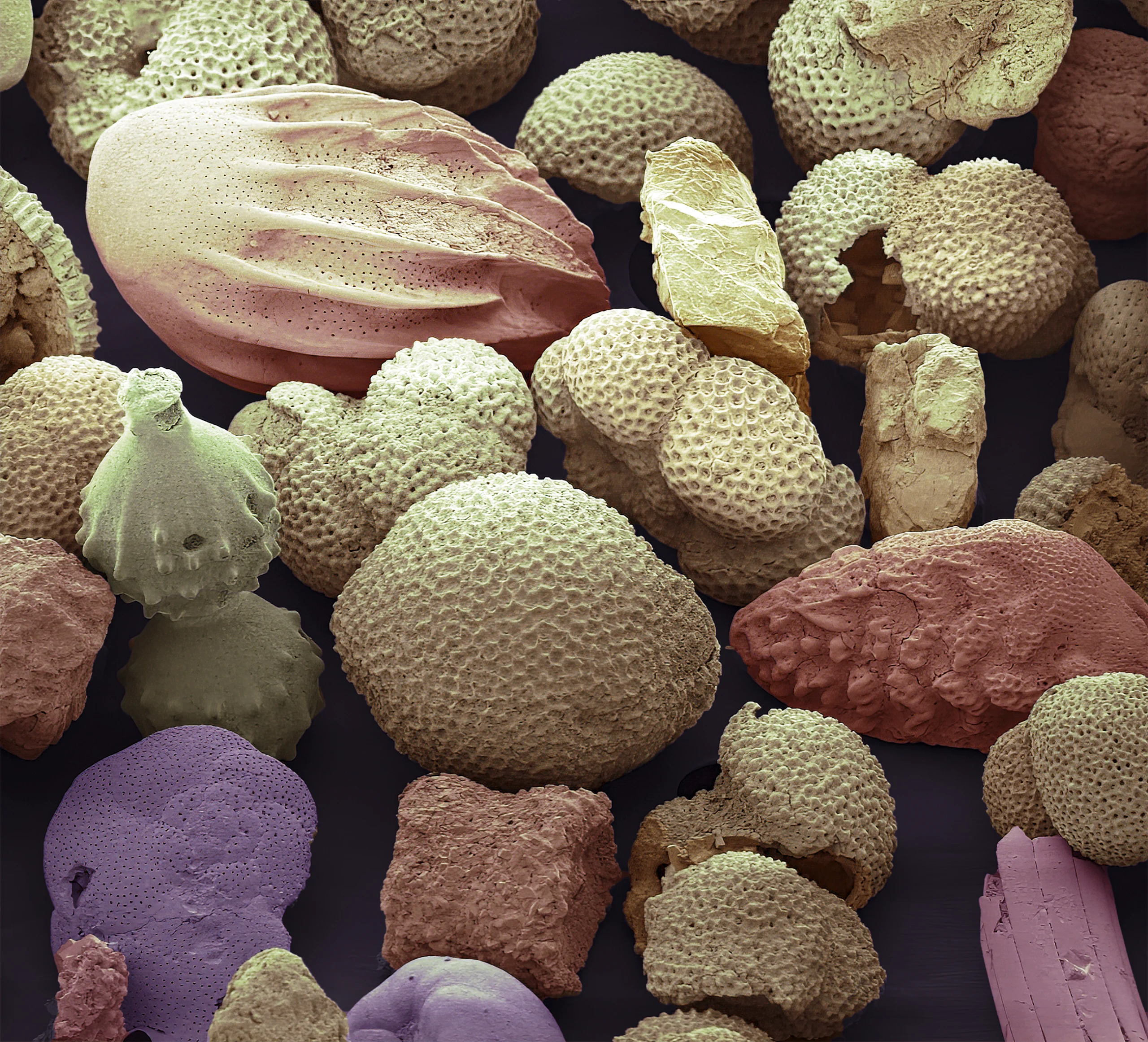 A scanning electron micrograph of foraminifera shells.