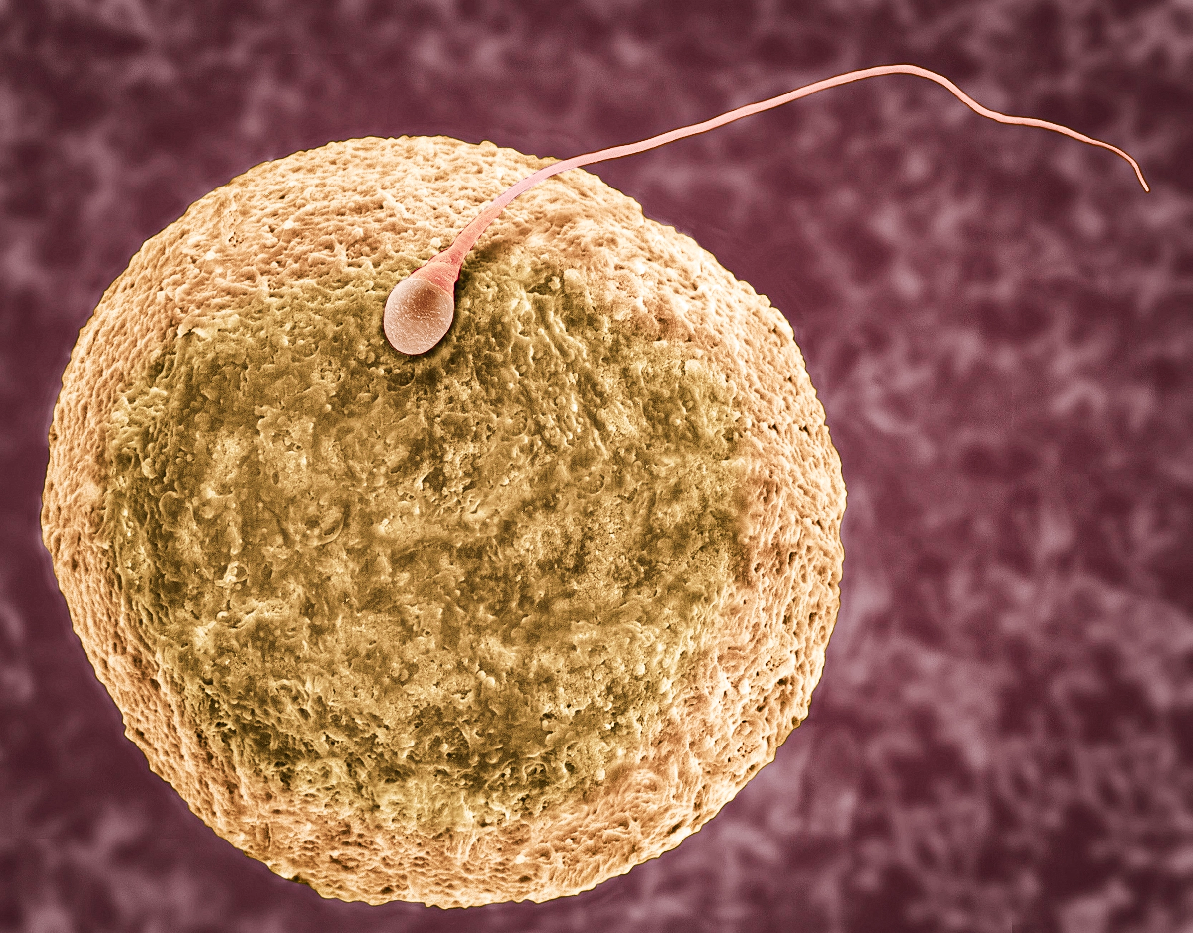 A micrograph shows a sperm cell on an egg cell.