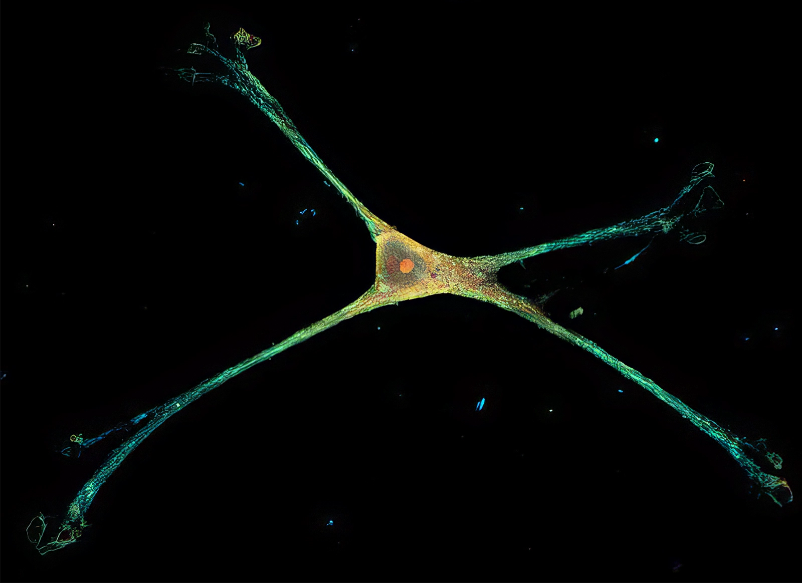 Long tendrils extend from an astrocyte cell body.