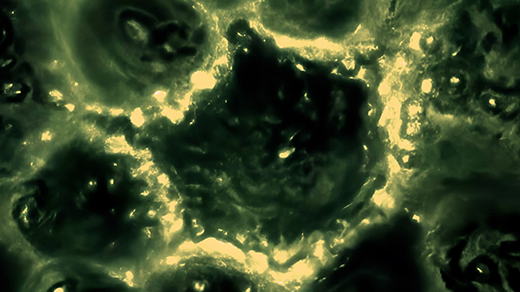 A video focuses on one cell in tissue. Its boundary lights up, and then the cell shrivels.