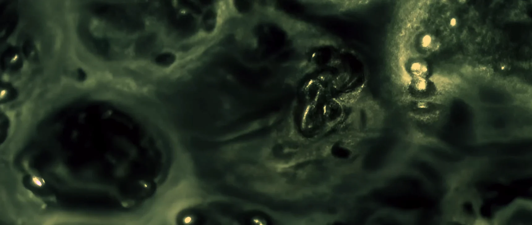 A video focuses on one cell in tissue. Its boundary lights up, and then the cell shrivels.