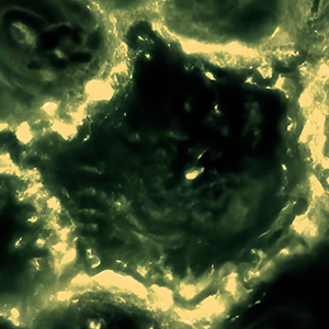 A video focuses on one cell in tissue. Its boundary lights up, and then the cell shrivels.