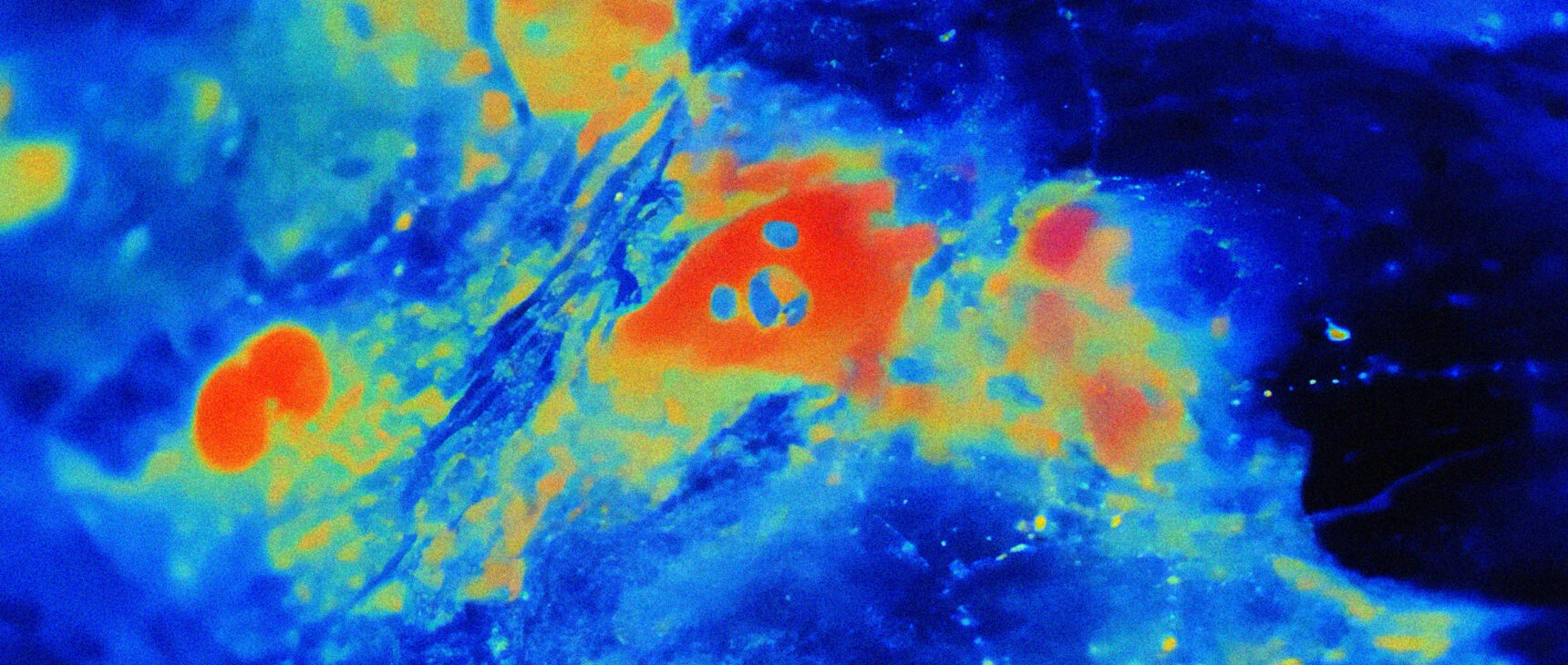 Bright spots of red (calcium) travel in waves across a blue substrate (brain cells).