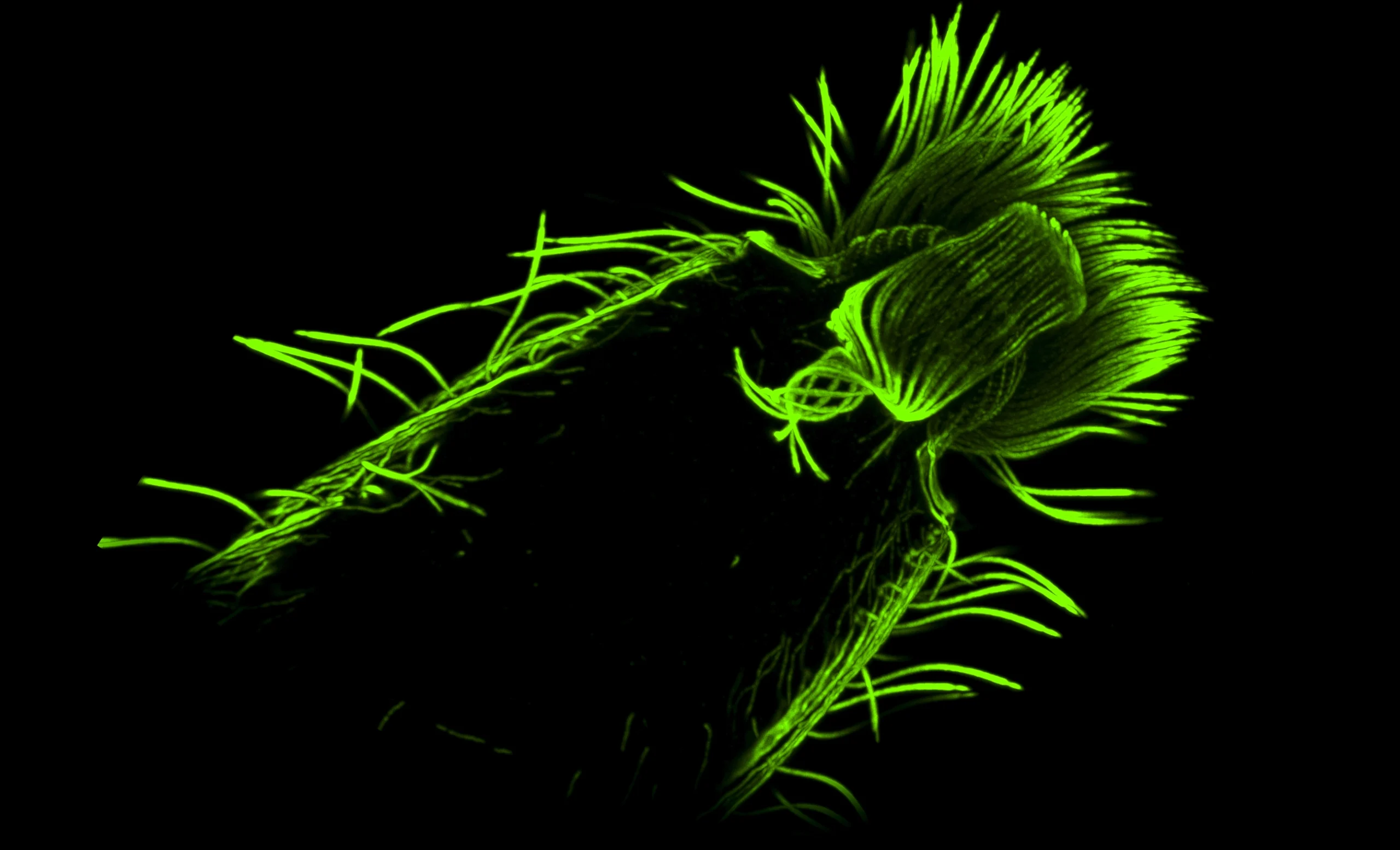 Fluorescence micrograph showing the feeding structure of the predatory ciliate Lacrymaria, stained in green.