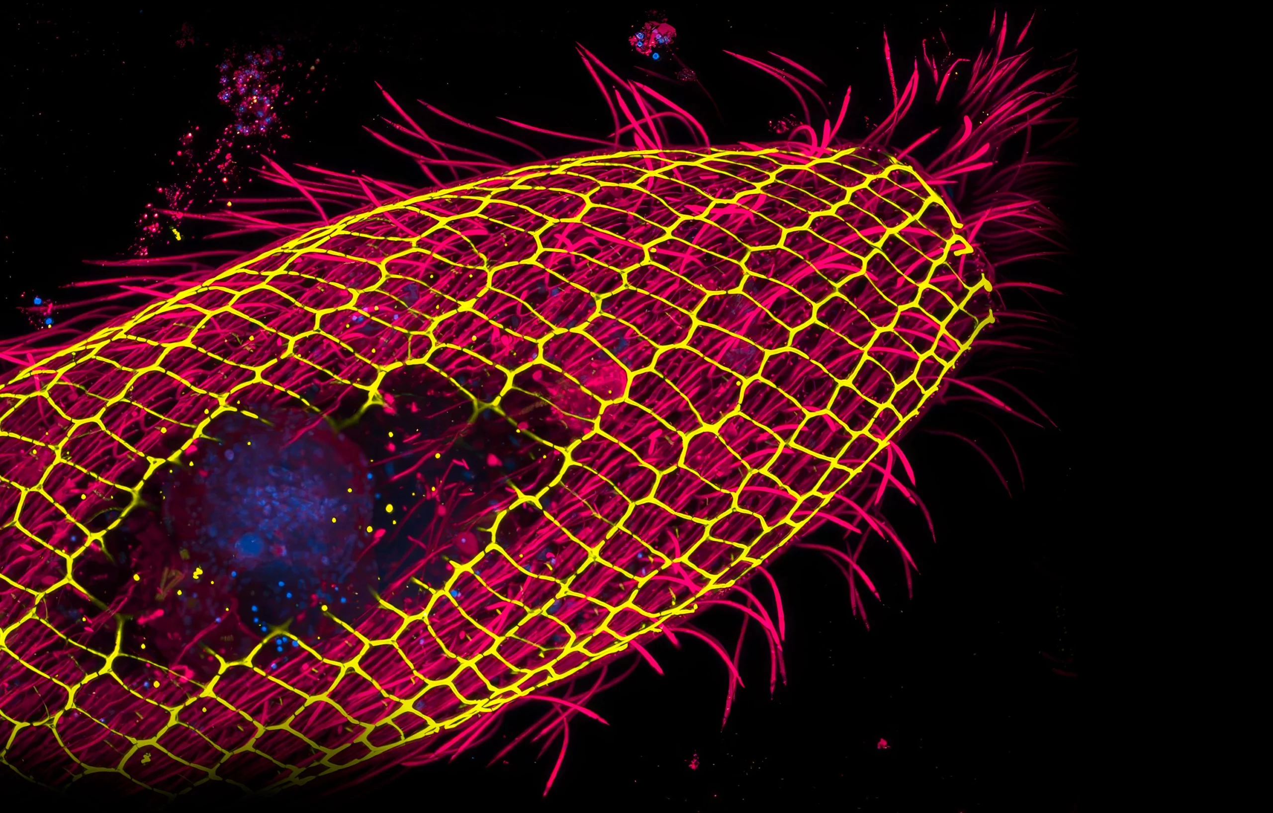 Fluorescence micrograph showing the mesh-like cell cortex of a Vorticella cell, stained in yellow and magenta.