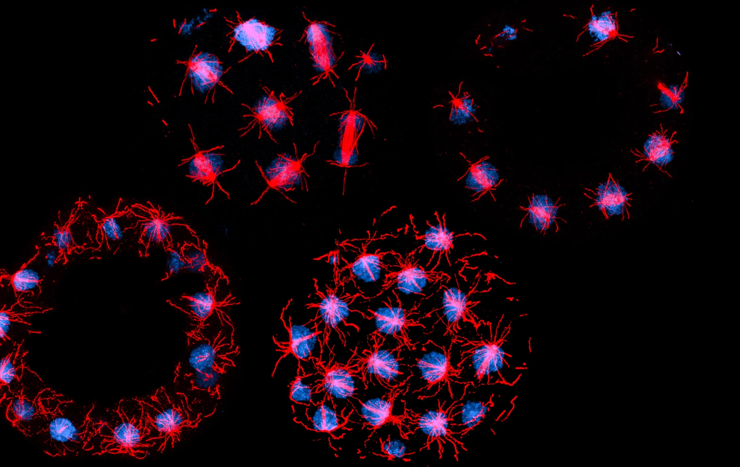 Fluorescence micrograph showing Sphaeroforma arctica cells at different stages of their life cycle. There are two upper cells and two lower cells, each with multiple nuclei stained in blue and red.