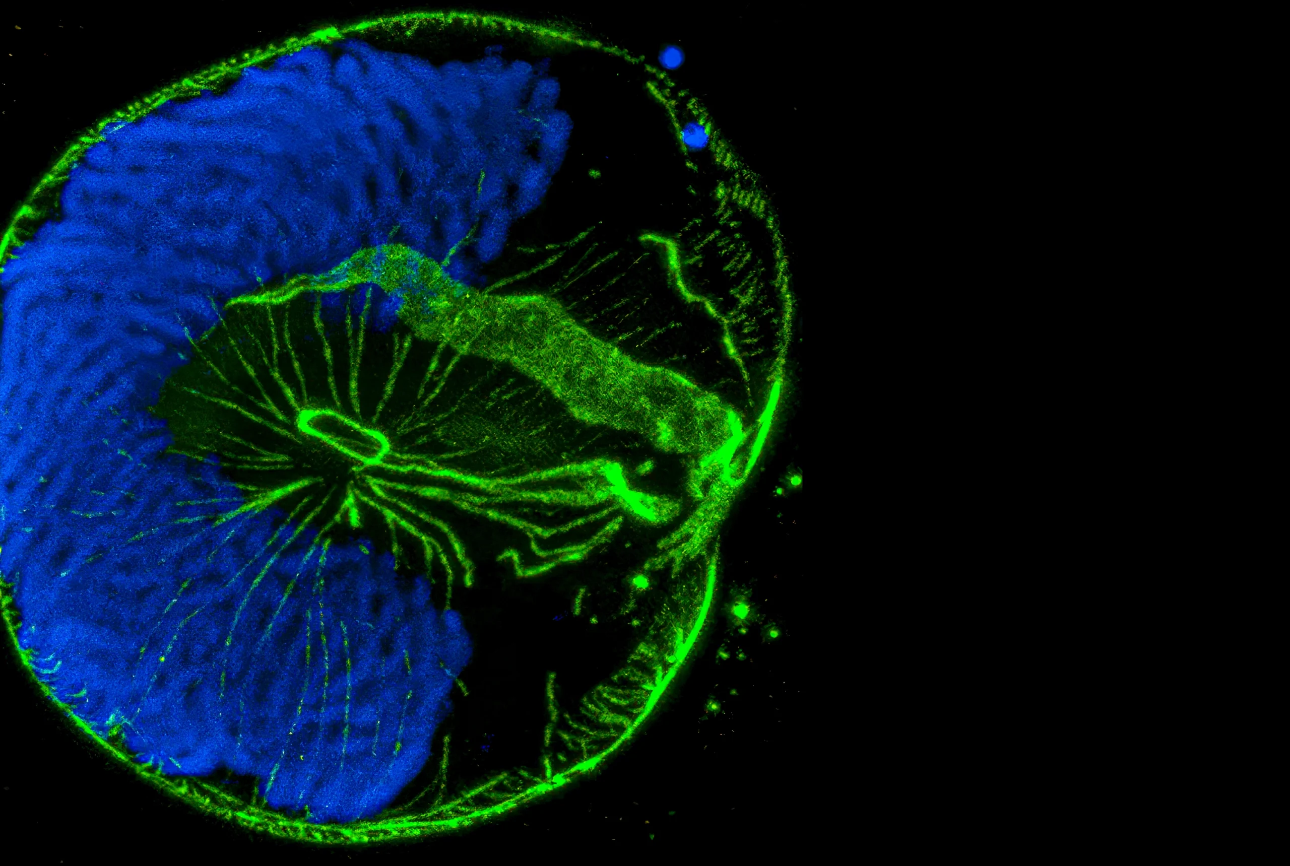 Fluorescence micrograph showing the dinoflagellate Lingulodinium polyedra, stained in blue and green.
