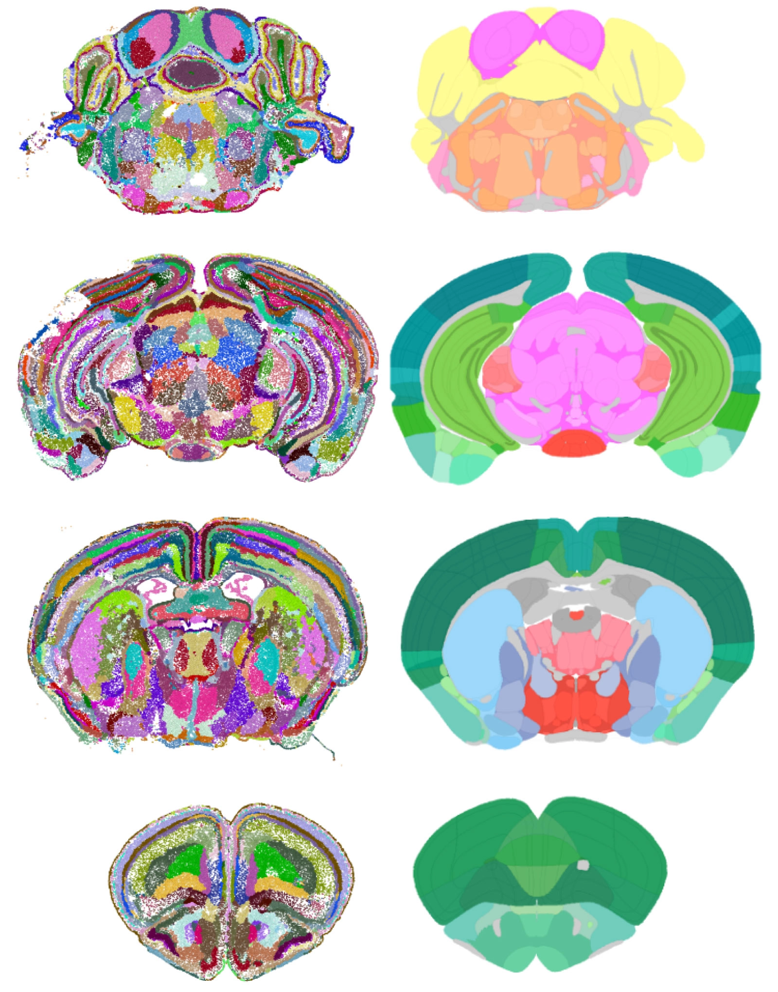 Two brain map types are compared side by side: The AI maps show more subregions, which are also smaller and represented as collections of individual cells; the research-made maps trace smoother, larger areas.