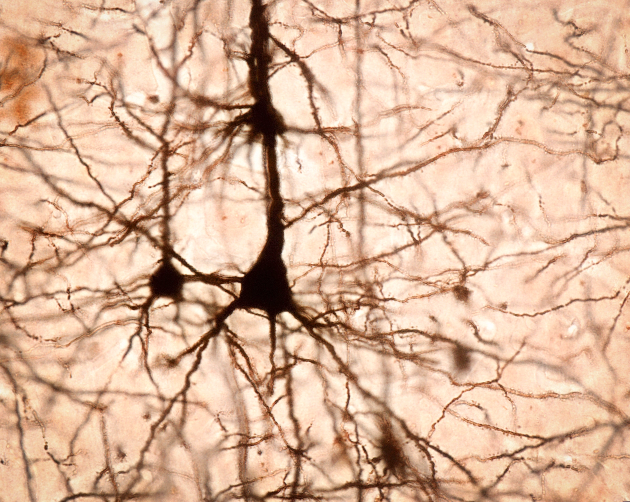 Thin branches extend from a neuron’s central hub.