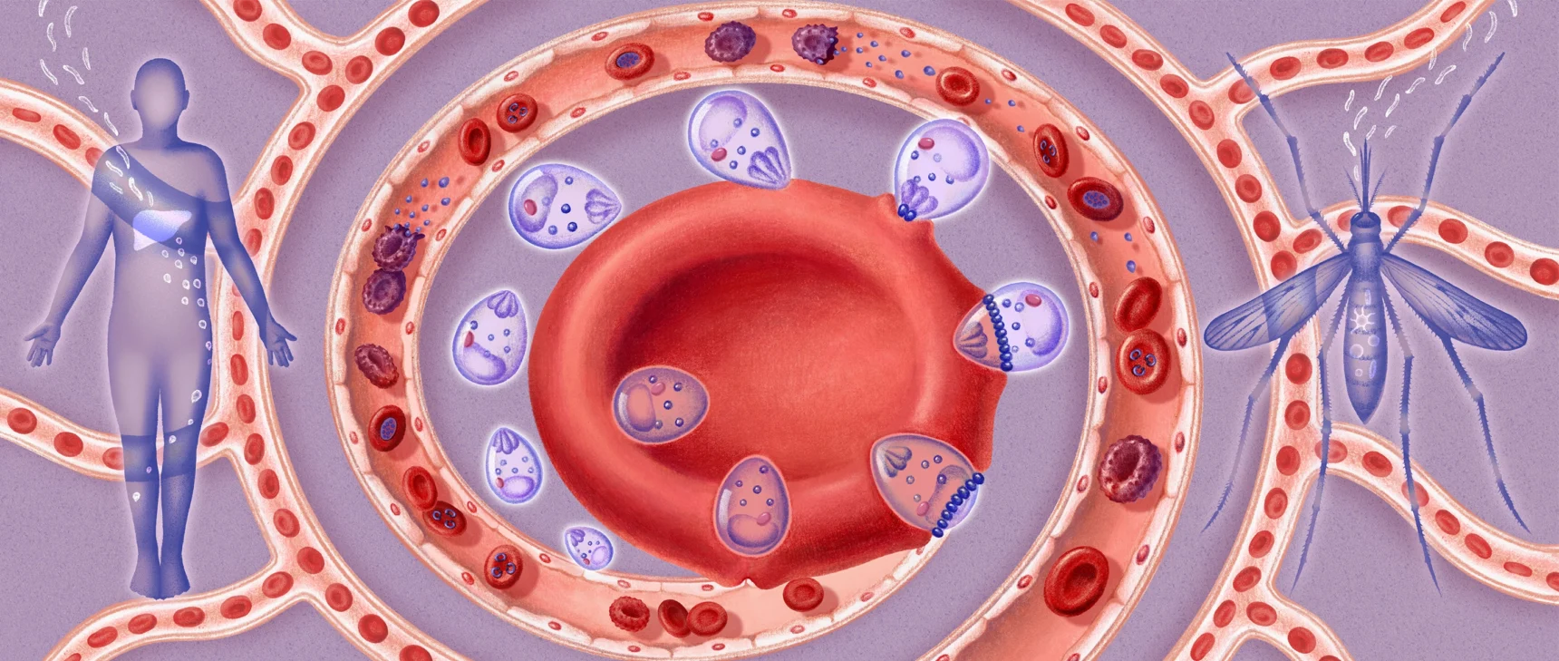 An illustration shows a small parasite, in stages, pressing into a central red blood cell. Surrounding blood vessels show the blood cell infection in its different stages.