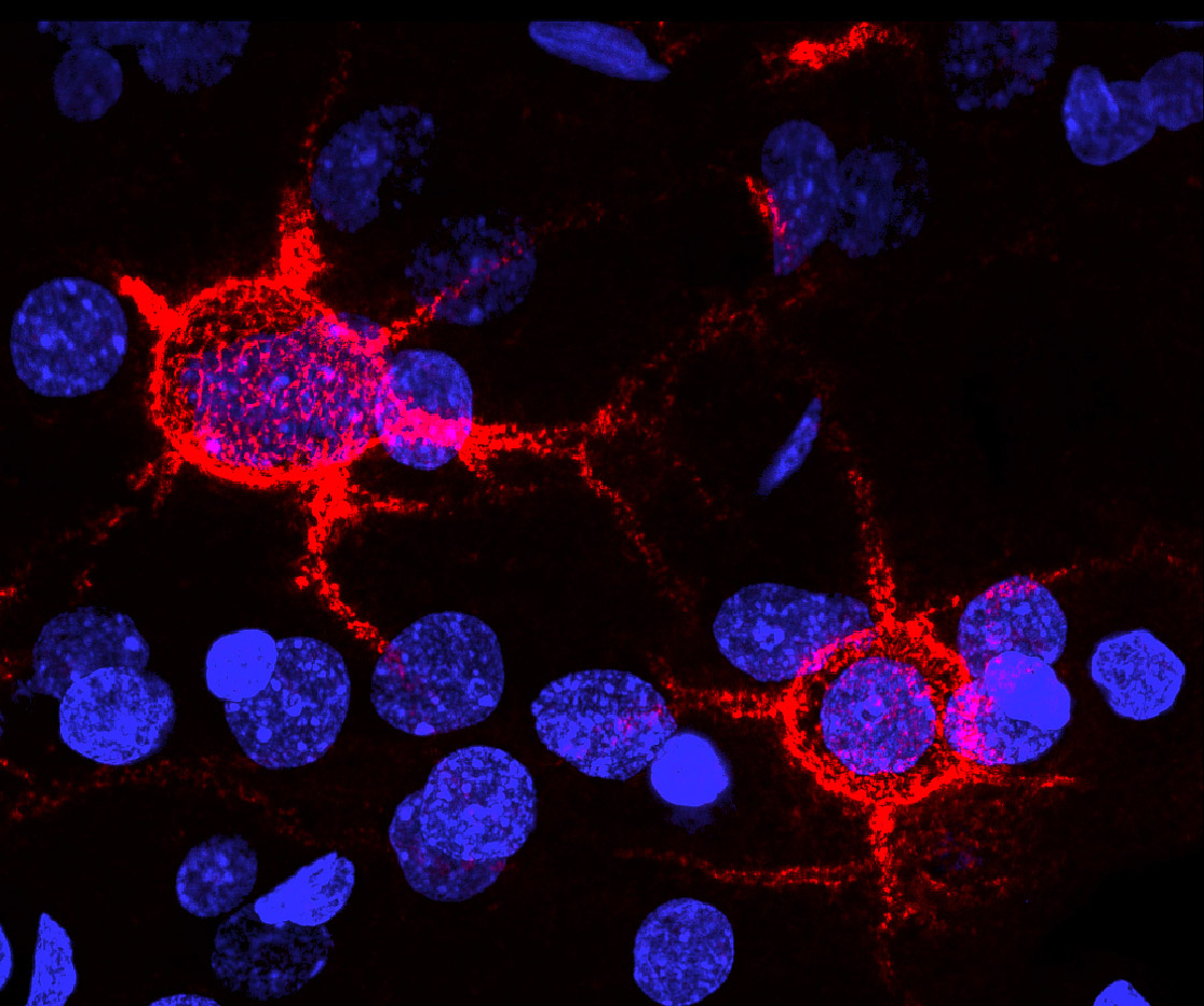 Red net-like structures surround neurons with blue nuclei.
